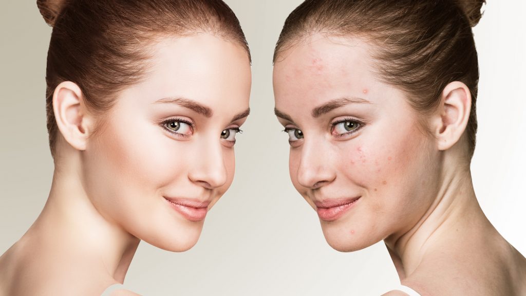 Gesichts Behandlungen AEDIS Beauty Dein Schönheitssalon in München